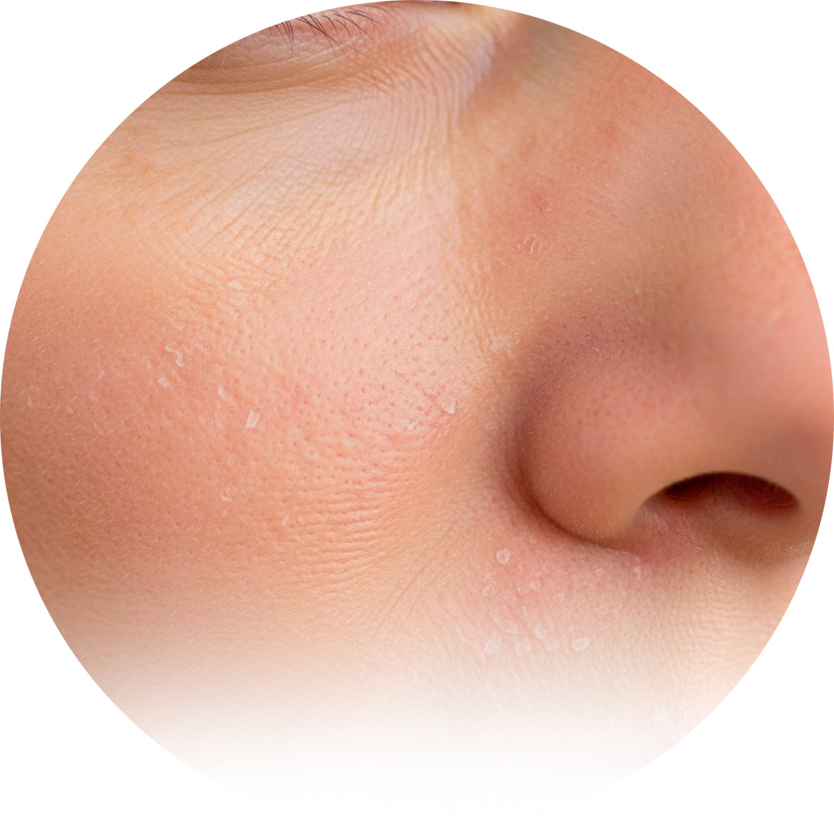 For Rough & Sensitive Skin